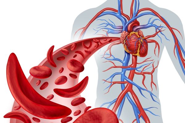 Akdeniz Anemisi Talasemi Nedir Belirtileri Tasiyicisi Ve Tedavisi 3