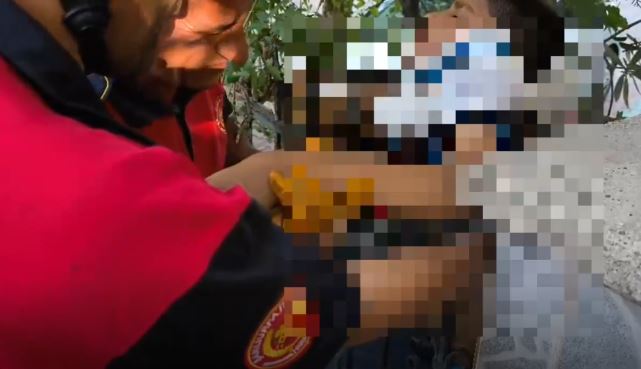 Karaköprü’de Oyun Oynayan Çocuğun Kolu Demir Korkuluklara Saplandı (2)