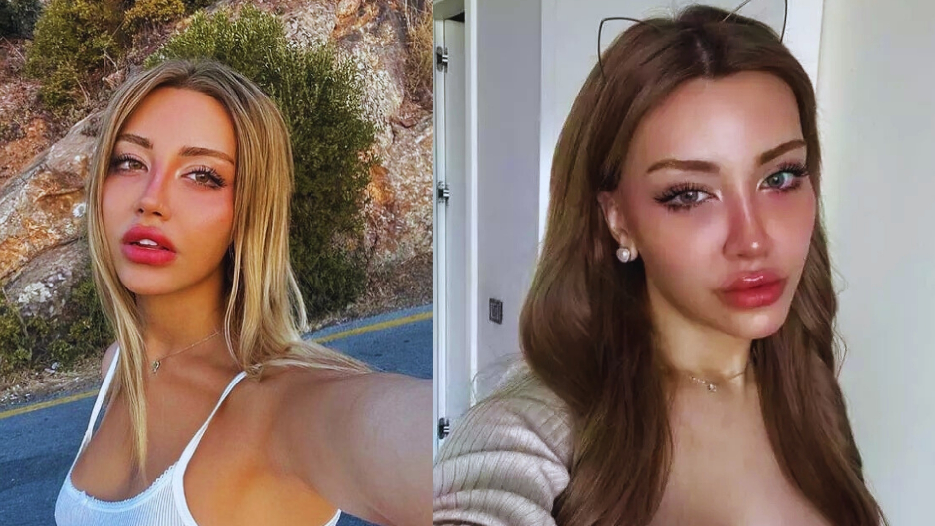 Şanlıurfalı Fenomen Mika Raun Kimdir? - Urfa Haberleri