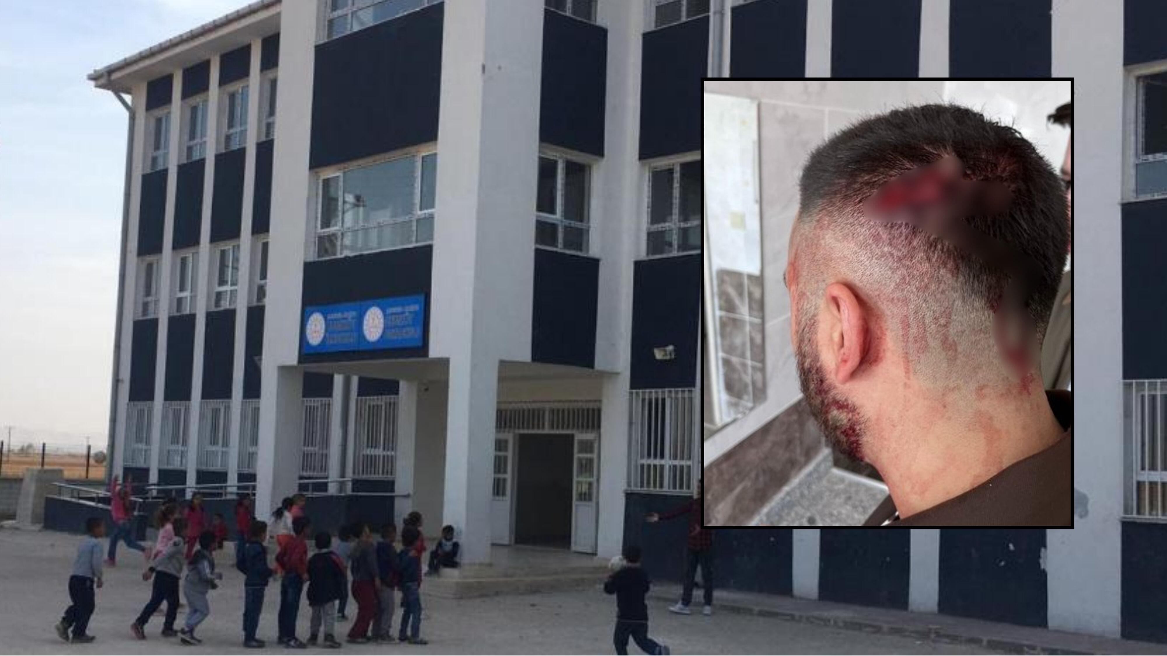Şanlıurfa’da Öğretmene Okulda Sopalı Saldırı!
