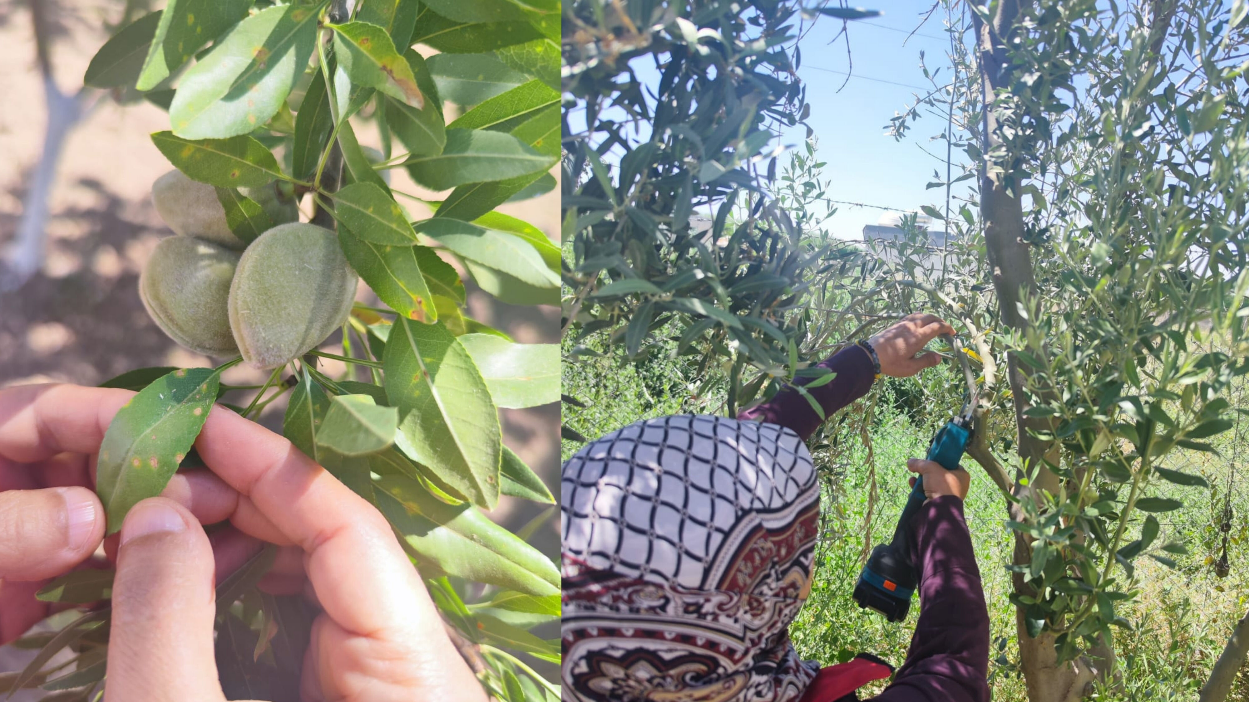 Fungal Hastalik Ve Besi̇n Eksi̇kli̇ği̇ Tespi̇ti̇