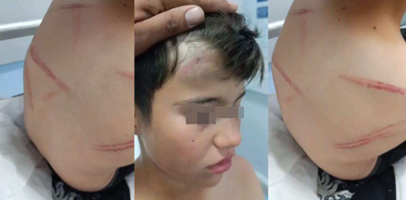 Şanlıurfa'da 17 Yaşındaki Genç 11 Yaşındaki Çocuğu Darp Etti